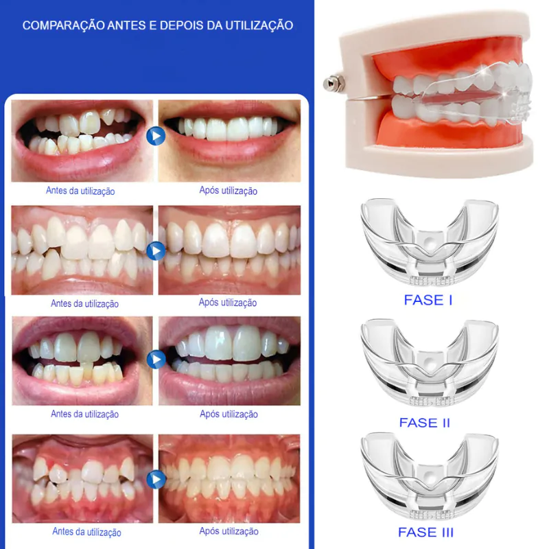 Placa Para Bruxismo Miorrelaxante